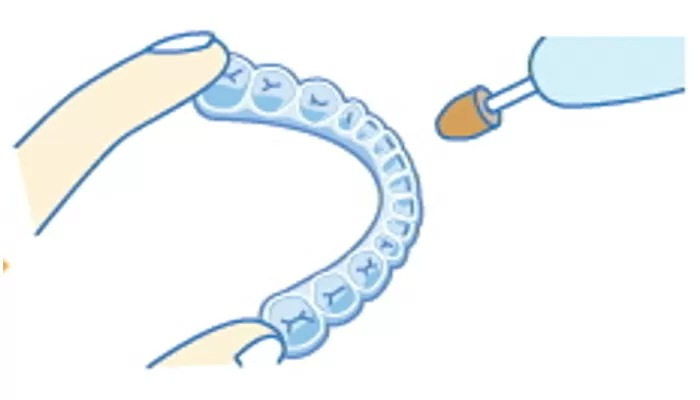 2. スプリント作製
